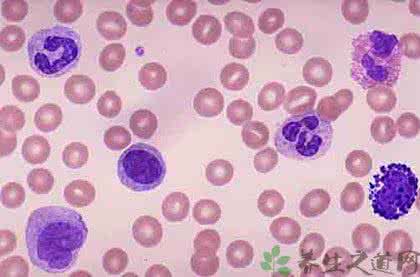 什么原因导致白细胞低 白细胞高的原因 多种原因导致白细胞高