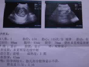 b超单数据怎么看性别 b超单数据怎么看性别 B超单数据看性别