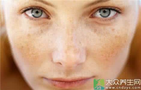 心血管疾病的十大信号 脸上的6大疾病信号，一看便知