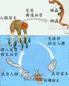 血吸虫病的危害 血吸虫病的危害 血吸虫病的危害性