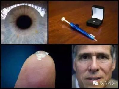 2017年同仁近视眼手术 到2017年,世上可能就没有近视眼了