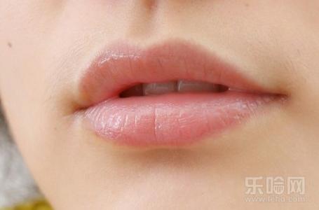 上火嘴唇起泡怎么办 嘴唇上火怎么办 嘴唇上火起泡怎么办 两大招消灭火