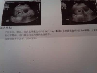 怀孕6周症状 【怀孕6周】怀孕6周症状