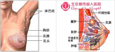 乳腺增生吃什么药最好 乳腺增生可以怀孕吗？乳腺增生吃什么药最好