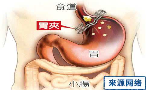 老胃病我有食疗偏方 胃病多由心病起 防治消化性溃疡先疗心病