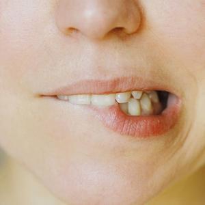 牙齿上黄黄臭臭的东西 牙齿上黄黄臭臭的东西 牙齿内侧黄黄的脏东西怎么去除？