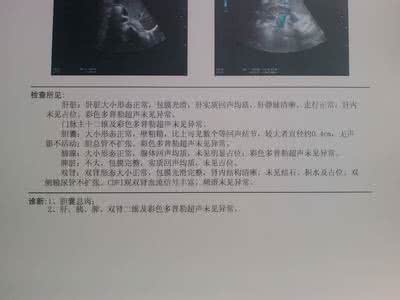 胆囊息肉的治疗方法 胆囊息肉的绝密方