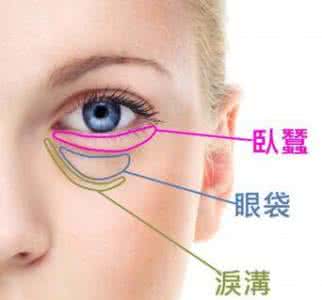 去眼袋最有效的土方法 怎样去除眼袋