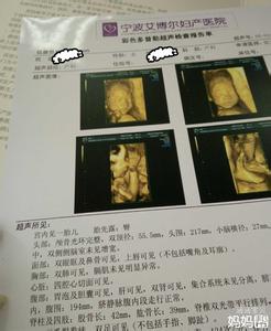 四维彩超前准备什么 四维之后做什么检查 做四维彩超前要做什么准备?这4点一定要记牢!