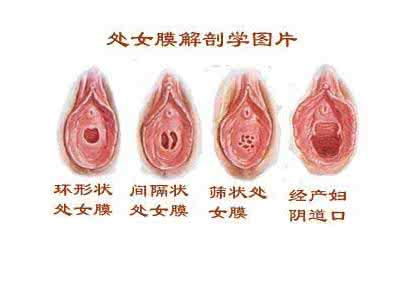 土壤修复技术及优缺点 处女膜修复术的优缺点详细介绍