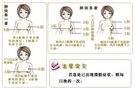 乳腺增生中医治疗方法 中医治疗乳腺增生 多种中医方法治乳腺增生
