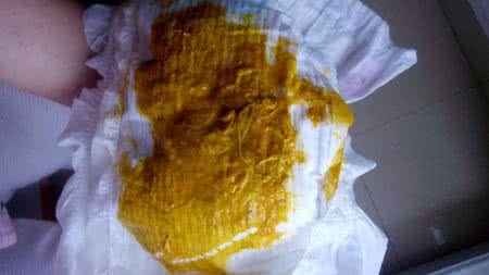 迅速治宝宝拉肚子偏方 6个月宝宝拉肚子怎么办