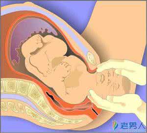 剖腹产几年后可以顺产 剖腹产后可以顺产吗