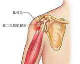 腱鞘炎最佳治疗方法 腱鞘炎2方