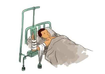 手臂骨折愈合时间 骨折病人吃什么好？骨折愈合的时间