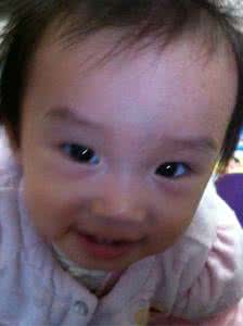婴儿鼻梁青筋怎么回事 婴儿鼻梁上有青筋 大人鼻梁青筋怎么回事?