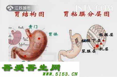 胃部幽门螺杆菌 胃部幽门螺杆菌 别让幽门螺杆菌“吞噬”了你的胃!
