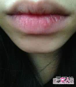 涂口红嘴唇起皮小妙招 涂口红嘴唇起皮 涂口红嘴唇为什么起皮?