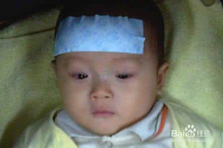 手足口病不发烧出疹子 孩子发烧又出疹子当心4种病