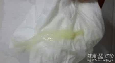 妇科白带 黄色白带最严重 透过白带看妇科病