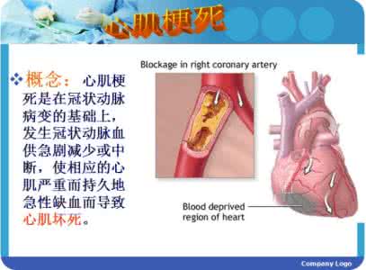 冠状动脉粥样硬化 冠心病诊断金标准 冠状动脉粥样硬化性心脏病的诊断