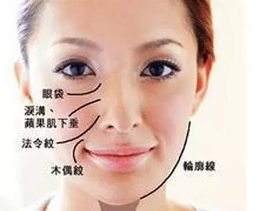 如何消除脸上的皱纹 如何赶走脸上的皱纹