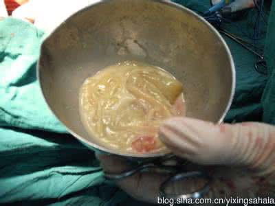 包虫病 祖传秘方：肝包虫疗效显著冬瓜仁姜黄汤