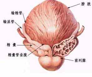 细菌性前列腺炎原因 慢性细菌性前列腺炎 炎症出现的常见原因