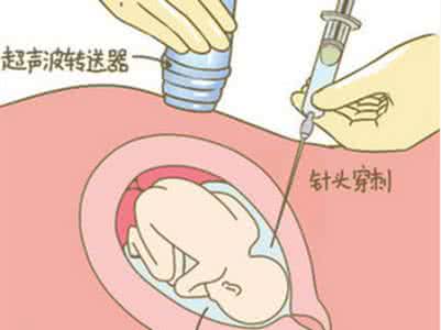 羊水穿刺具体检查什么 羊水穿刺检查是什么