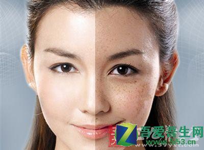 怎样淡化咖啡斑 色斑是怎么回事 教你怎样有效祛除色斑