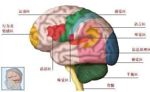 脑溢血前兆 脑溢血前兆 正确了解脑溢血