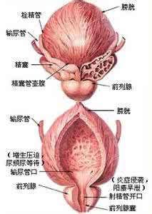 男性前列腺炎病的症状 前列腺炎是什么病 前列腺炎的症状有哪些