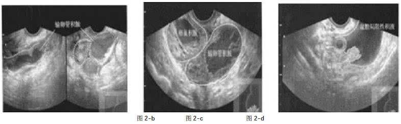 急腹症影像学 急腹症影像学诊断 常见颅脑急症的影像学诊断