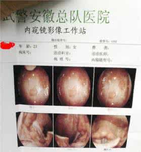 咽喉炎最佳治疗方法 图文：治疗咽炎的9个小验方