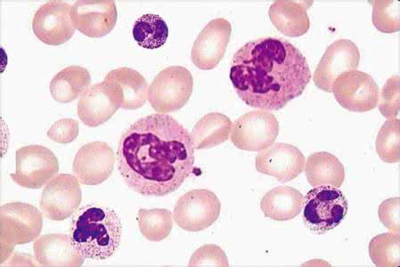 中性粒细胞百分比 中性粒细胞百分比 对中性粒细胞百分比解释