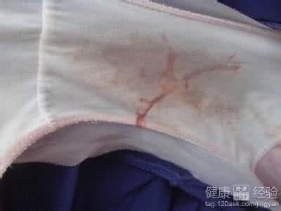 排卵期出血影响怀孕吗 排卵期出血是什么颜色 排卵期出血影响怀孕吗