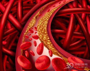 疏通脑血管的偏方 疏通血管的绝密偏方