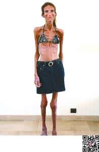 减肥经验分享 20天减肥5公斤经验分享