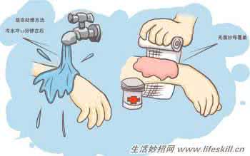手上磨出水泡处理偏方 烫伤后起水泡怎么处理 烫伤处理的偏方