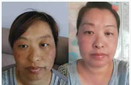乐敦cc美白淡斑精华 当食盐遇上它8分钟急速美白淡斑，7天40岁大妈重塑婴儿肌
