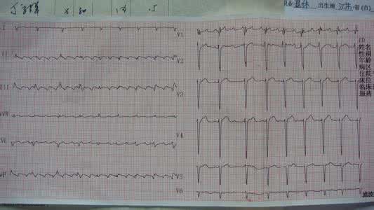 慢性肺心病治疗 慢性肺心病治疗 史伟对治疗慢性肺心病的新认识