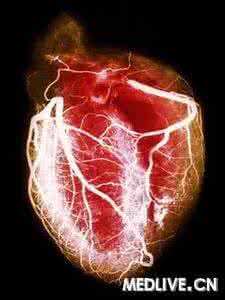 心脏卫士 咖啡：血管卫士还是心脏杀手？