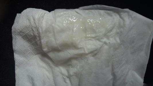 月经推迟白带发黄 月经推迟白带多的原因 白带黄月经推迟的原因