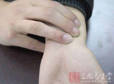人类健康四大杀手疾病 细节看健康 手部7个信息预示疾病