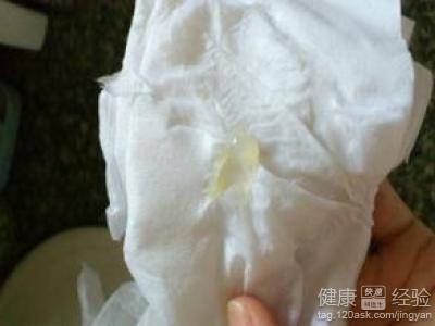 孕妇白带发黄怎么处理 孕妇白带多怎么办