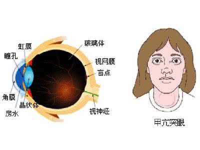 甲亢遗传几率有多大 甲亢的危害 甲亢的危害 看看甲亢危害有多大