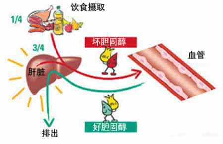 低密度脂蛋白胆固醇 让胆固醇赶走胆固醇:植醇清除血中低密度胆固醇