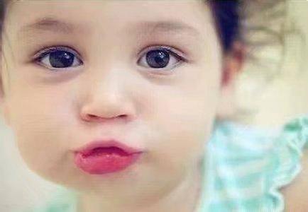 雀斑吃什么能去掉 脸上的斑一吃就掉，看你会吃不会吃！