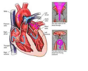 治疗风心病的特效药 风心病二尖瓣狭窄 二尖瓣狭窄的病因