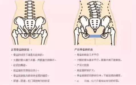 产后骨盆修复的重要性 产后骨盆修复的重要性 【至尊妈妈】产后骨盆修复的重要性